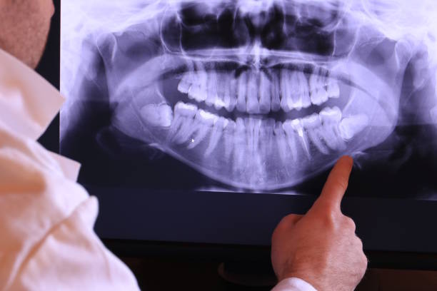 Best Emergency Root Canal Treatment in Rinna, VA