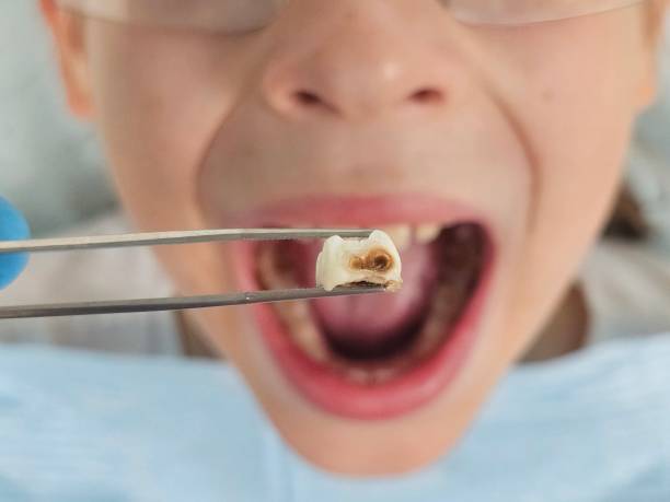 Best Emergency Dental Services for Seniors in Rinna, VA
