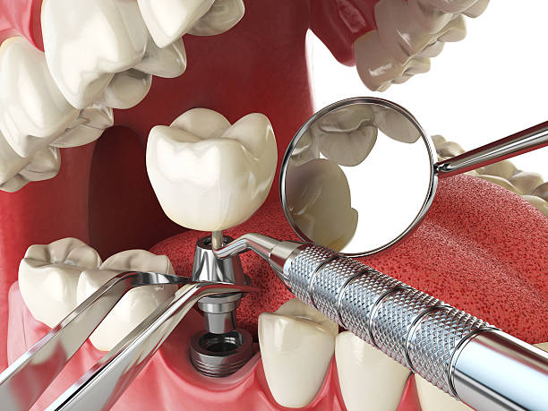 Best Weekend Emergency Dentist in Rinna, VA
