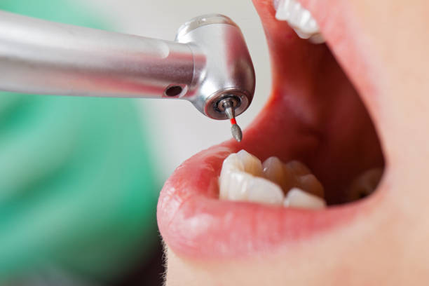 Best Orthodontic Emergency Dentist in Rinna, VA
